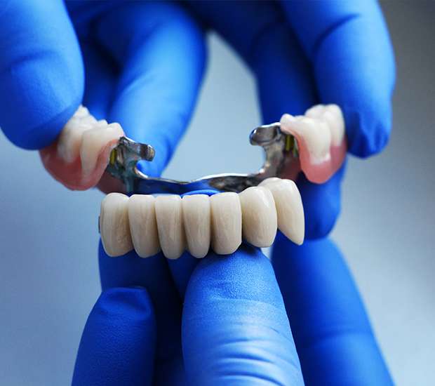 Atlanta Dental Bridges