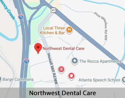 Map image for Options for Replacing Missing Teeth in Atlanta, GA