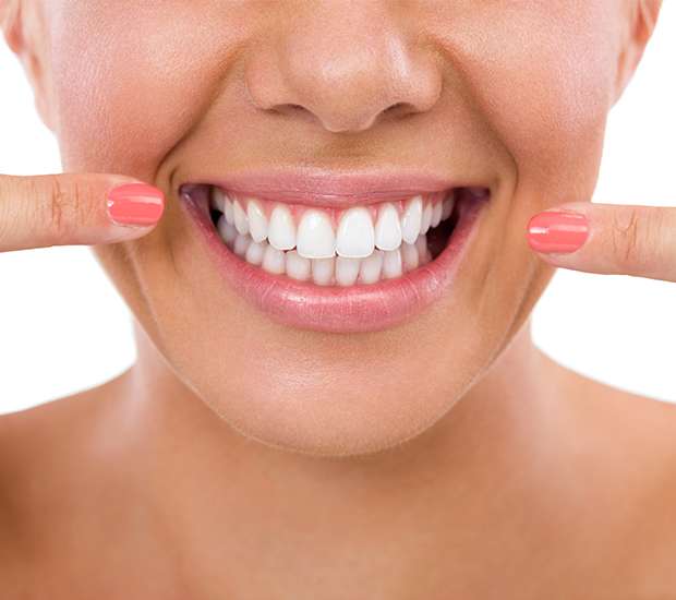 Atlanta What Is Gum Contouring and Reshaping