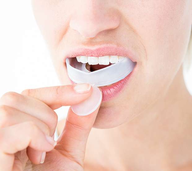 Atlanta Mouth Guards