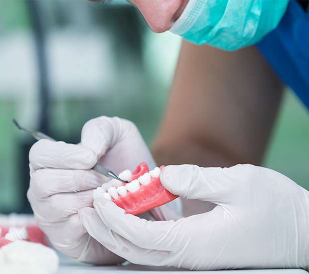 Atlanta Partial Denture for One Missing Tooth
