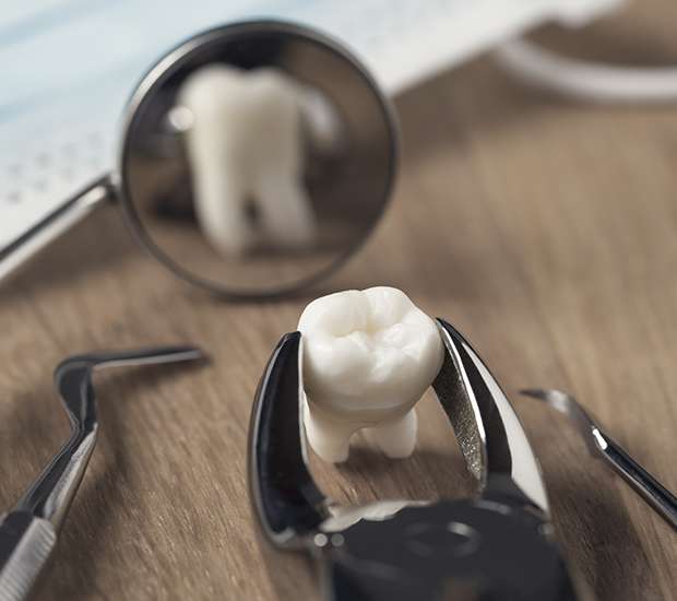 Atlanta When Is a Tooth Extraction Necessary
